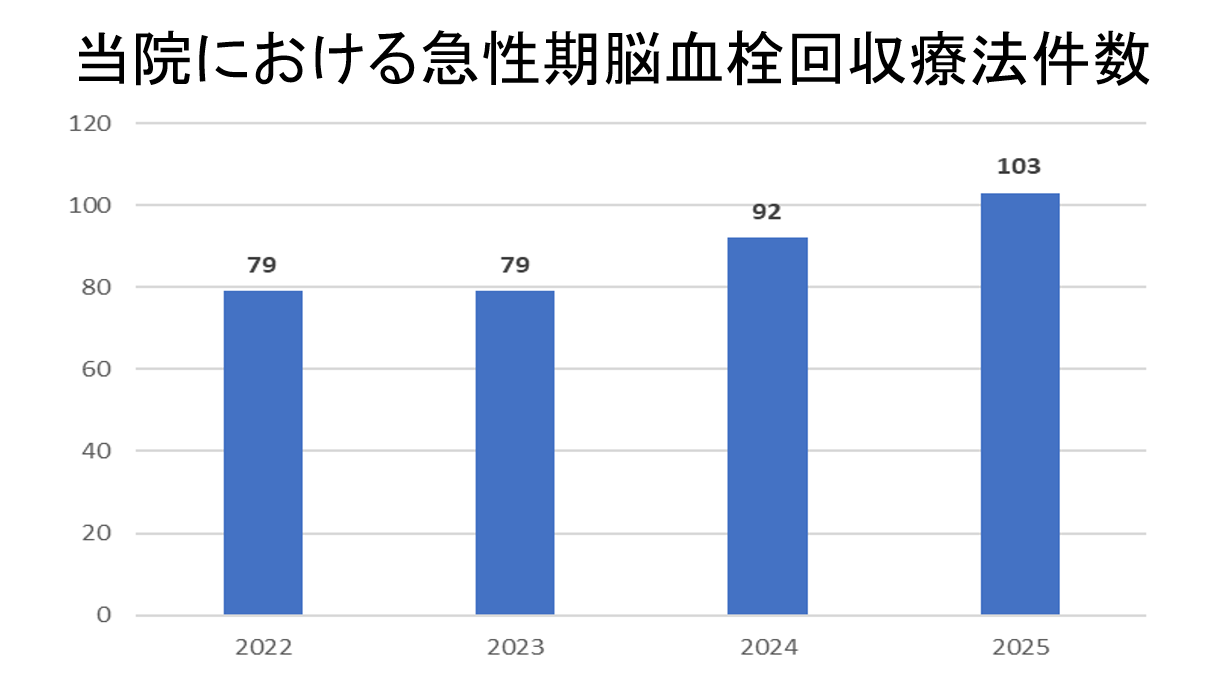 当院SCU:超急性期脳梗塞治療例数グラフ